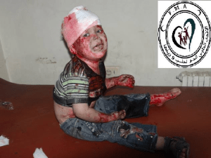 Aleppo, bimbo ferito